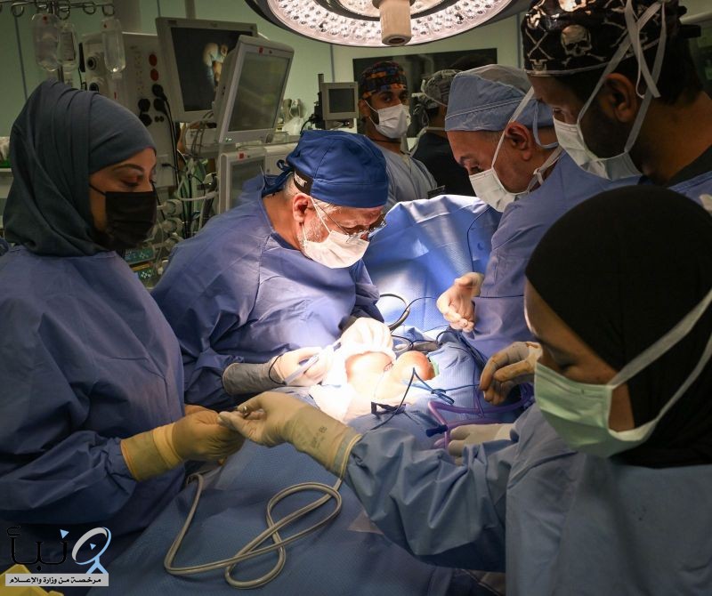 إنفاذًا لتوجيهات القيادة.. بدء عملية فصل التوأم الملتصق الجامايكي "أزاريا وأزورا إيلسون"