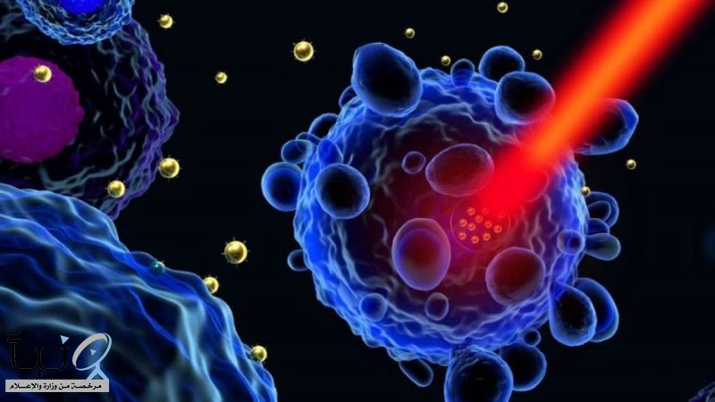 علاج ثوري جديد يقضي على الأورام لدى 82% من مرضى سرطان المثانة