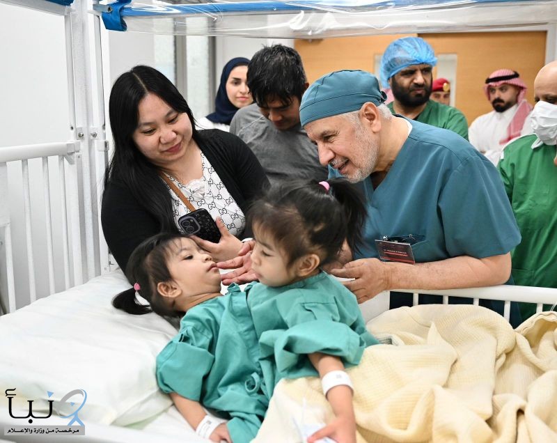 إنفاذًا لتوجيهات خادم الحرمين الشريفين وسمو ولي العهد.. بدء عملية فصل التوأم الملتصق الفلبيني (أوليفيا وجيانا)