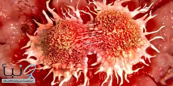 تطوير فيروس قادر على قتل كل أنواع السرطان