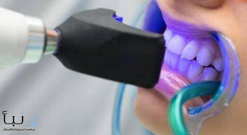 5 مخاطر لتبييض أسنانك بالليزر.. لا تتجاهلها
