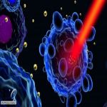 علاج ثوري جديد يقضي على الأورام لدى 82% من مرضى سرطان المثانة