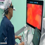 مستشفى الدكتور سليمان الحبيب بالمحمدية في جدة يُجري جراحة متقدمة بالروبوت لإنهاء معاناة ثلاثينية مع ورم بالمبايض