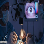 مستشفى الملك فهد التخصصي ينجح في استئصال ورم خلقي حميد من محجر عين فتاة